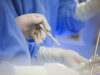 Ärzt:innen mit Skalpell in der Hand, Veranschaulichung zum Thema operative Myomentfernung